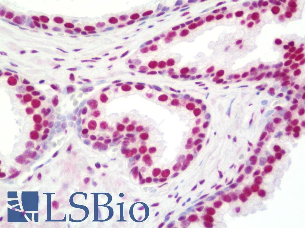 IHC-plus™ Polyclonal Rabbit anti-Human NONO / P54NRB Antibody (aa350-400, IHC)