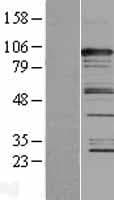 CASC3 / MLN51 Protein (Over-Expression Lysate Myc-DDK (Flag))