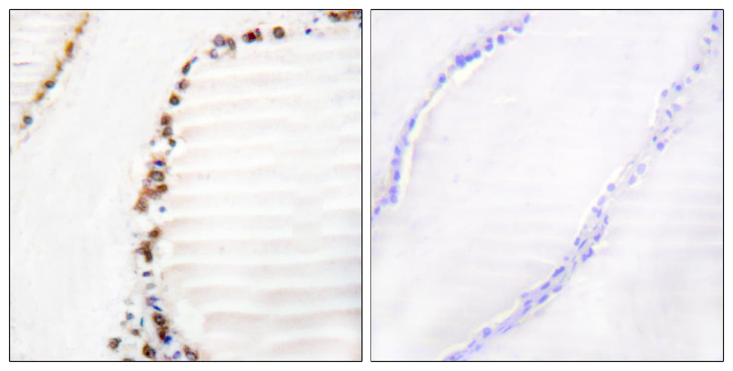 Polyclonal Rabbit anti-Human CUL3 / Cullin 3 Antibody (aa1-50, IHC)