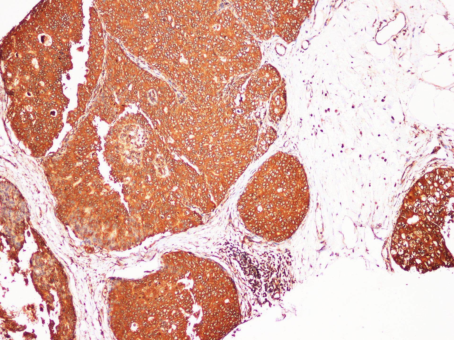S100A9 / MRP14 Antibody