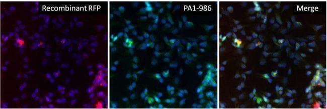 Goat Anti-Rabbit IgG Secondary Antibody (DY488)