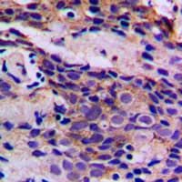 CDK5 Antibody (phospho-Tyr15)