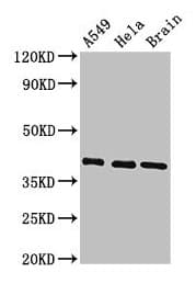 Polyclonal Rabbit anti-Human HLA Class I Histocompatibility Antigen, C-4 Alpha Chain Antibody (IHC, WB)