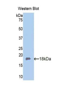 FBLN5 / Fibulin 5 Antibody (aa327-448)