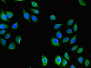 Polyclonal Rabbit anti-Human USHBP1 Antibody