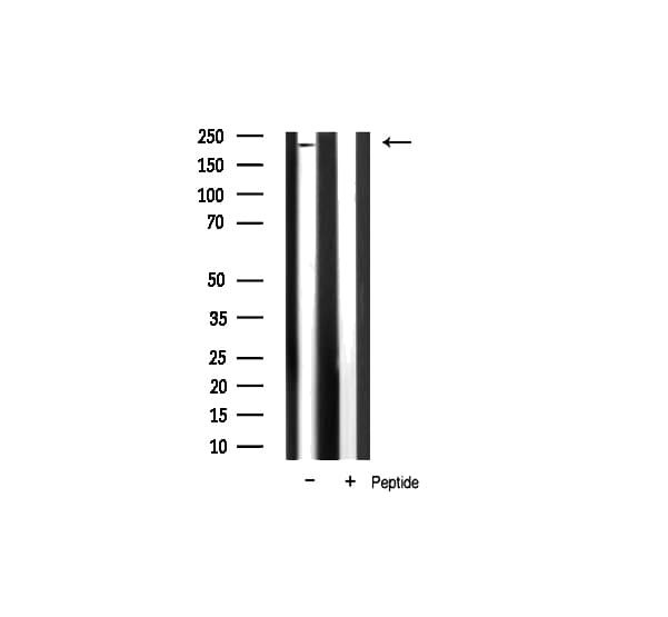 Polyclonal Rabbit anti-Human HAK / ALPK2 Antibody (IHC, WB)