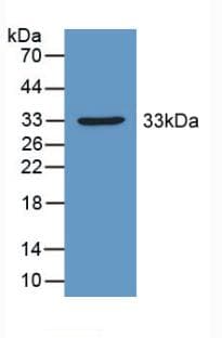 PDHX / Protein X / ProX Antibody (aa222-471, APC)