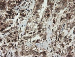 Monoclonal Mouse anti-Human PIK3CG / PI3K Gamma Antibody (clone OTI2B1, IHC, WB)