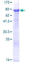 Human FANCC Protein (Recombinant GST)