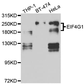 Polyclonal Rabbit anti-Human EIF4G1 / EIF4G Antibody (IHC, IF, WB)