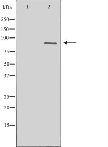 Polyclonal Rabbit anti-Human NTRK2 / TRKB Antibody (IHC, IF, WB)