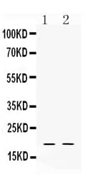 TRIM24 / TIF1 Antibody