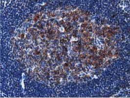ERIC-1 / TACC3 Antibody (clone OTI3B1)