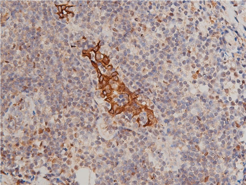 KRT8 / CK8 / Cytokeratin 8 Antibody (phospho-Ser432)
