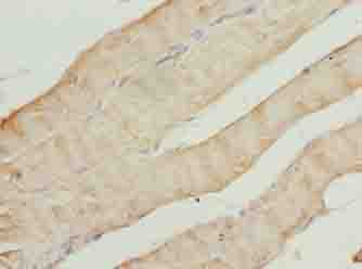 CAP2 Antibody