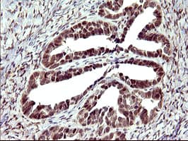 Monoclonal Mouse anti-Human UPRT Antibody (clone OTI1C9, IHC, WB)