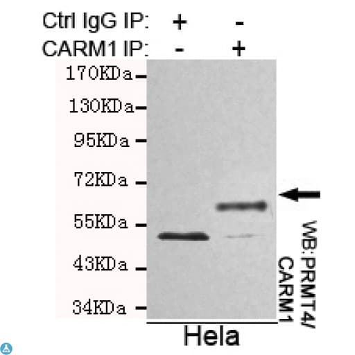 PRMT4 / CARM1 Antibody