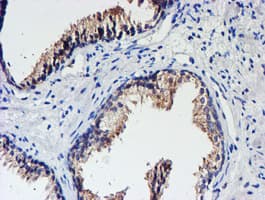 Monoclonal Mouse anti-Human UNG / Uracil DNA Glycosylase Antibody (clone OTI1G1, IHC, IF, WB)
