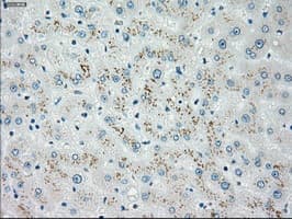 CHEK2 / CHK2 Antibody (clone OTI10G7)