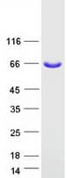 Human KBTBD5 Protein (Recombinant Myc-DDK (Flag))