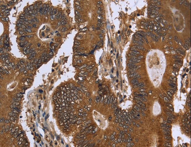 FGFRL1 Antibody