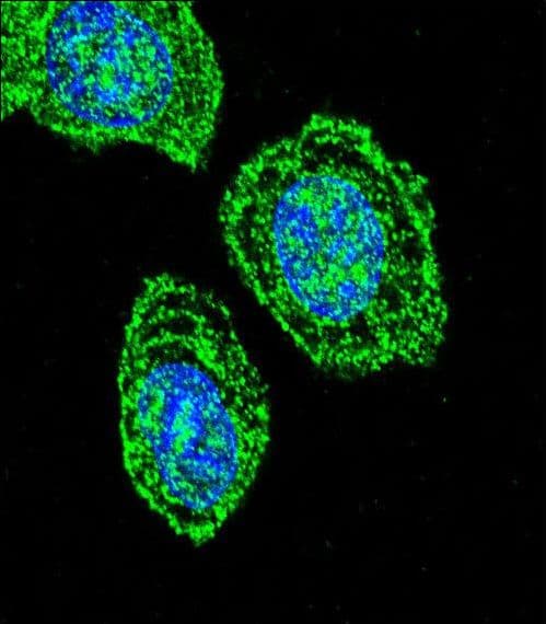 IHC-plus™ Polyclonal Rabbit anti-Human EIF2S1 Antibody (aa60-89, IHC, IF, WB)