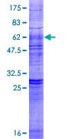Human LPAR3 / LPA3 / EDG7 Protein (Recombinant GST)