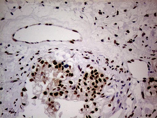 NSD3 / WHSC1L1 Antibody (aa427-566, clone OTI3B3)