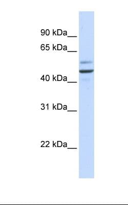 Polyclonal Rabbit anti-Human GOLM1 / GP73 / GOLPH2 Antibody (aa38-87, IHC, WB)