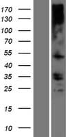 TMEM121 Protein (Over-Expression Lysate Myc-DDK (Flag))