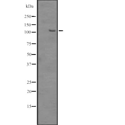SRRM1 Antibody