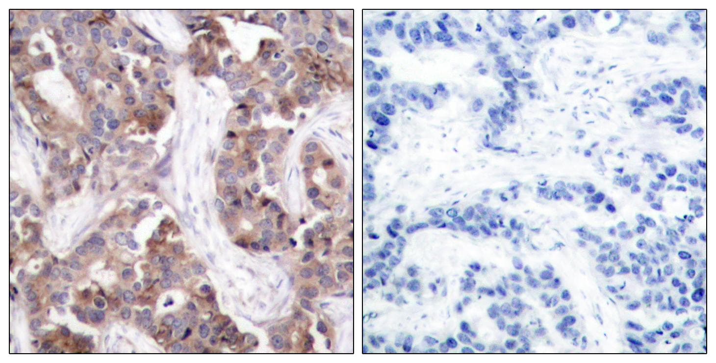 Histone H1 Antibody (phospho-Thr17)