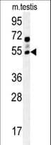GABRG2 Antibody (aa198-224)