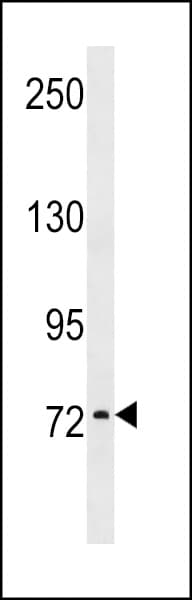 ANOS1 / Anosmin Antibody (aa166-194)