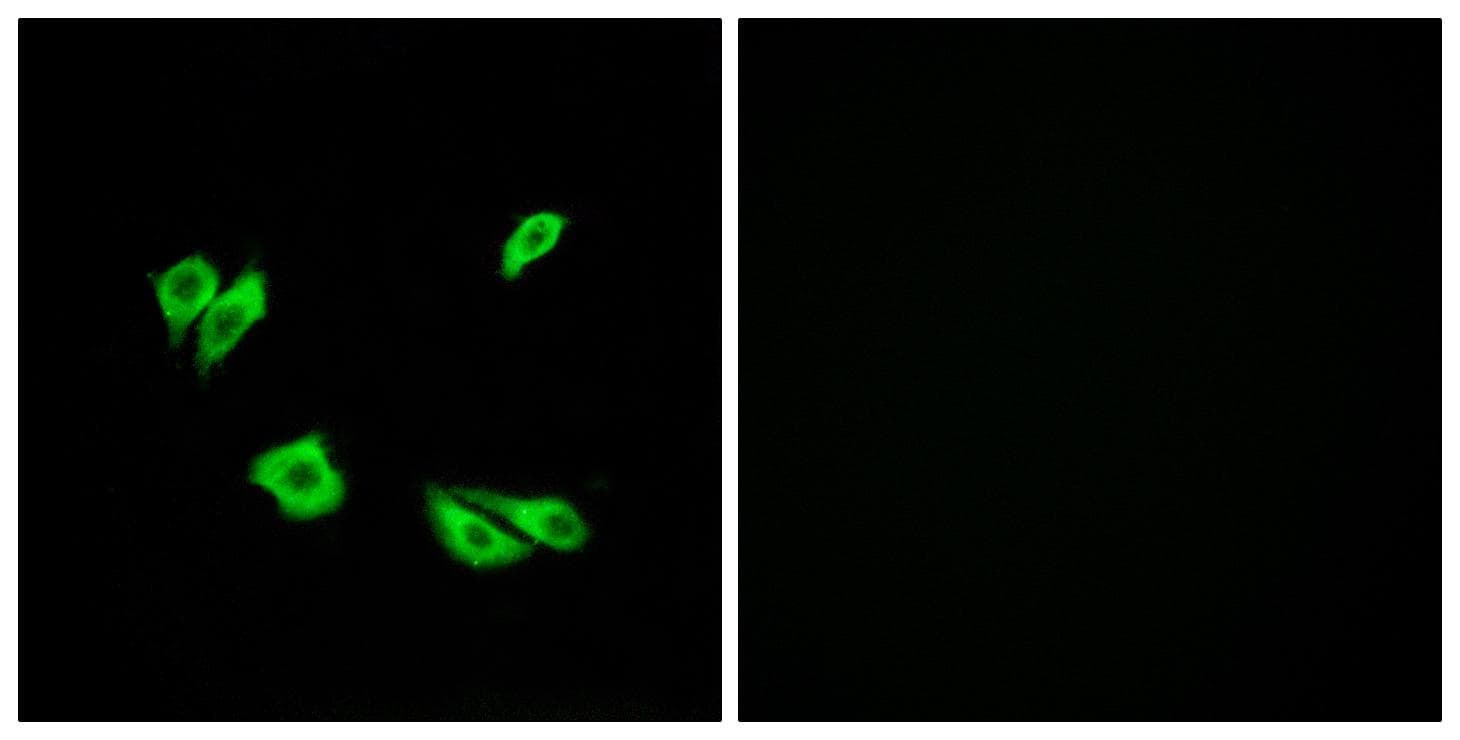 DAB1 Antibody (p220)