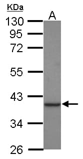 CKMT1B Antibody