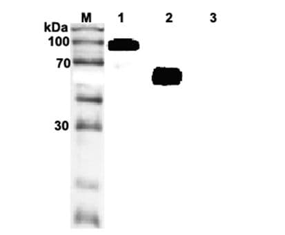 Monoclonal Mouse anti-Human IL1RL1 Antibody (clone ST33868, WB)