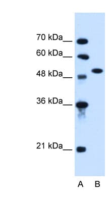 ALK2 / ACVR1 Antibody (aa80-129, HRP)