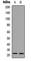 Polyclonal Rabbit anti-Human PXMP2 Antibody (Internal, IHC, WB)