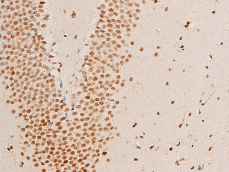 ERBB2 / HER2 Antibody (phospho-Tyr1248)