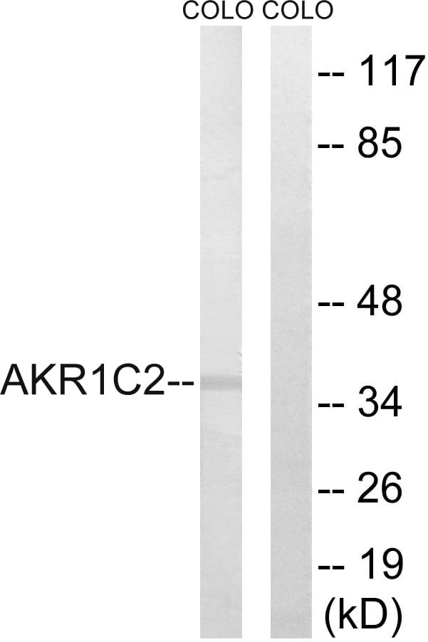 BABP / AKR1C2 Antibody (aa21-70)