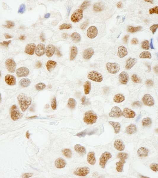 KHDRBS1 / SAM68 Antibody (aa1-50)