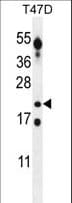 CT45A3 Antibody (aa100-129)