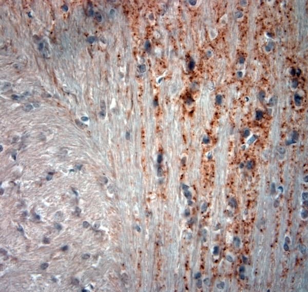 GAD 65+67 Antibody (aa530-600)