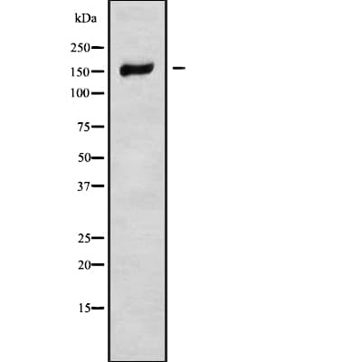 NCAPD3 / HCAP-D3 Antibody