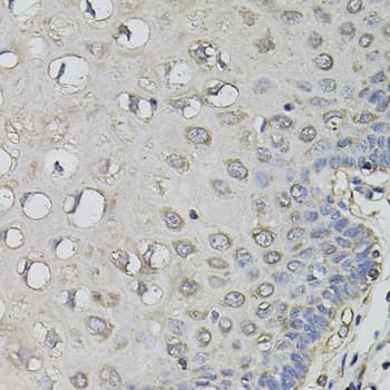 AMPD1 Antibody