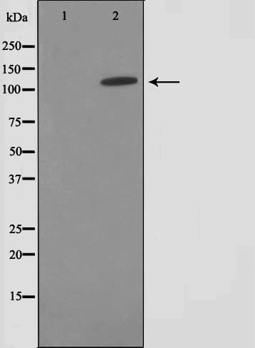 FARP2 / FRG Antibody