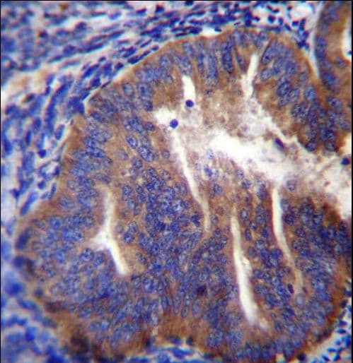 KLC2 Antibody (aa128-156)