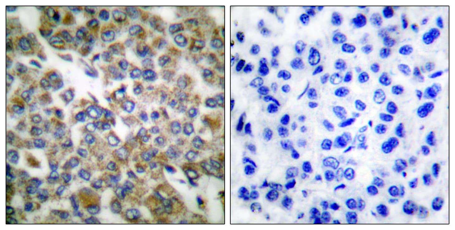 KRT14 / CK14 / Cytokeratin 14 Antibody (aa1-50)