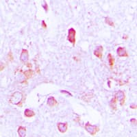 CDC37 Antibody (Internal)